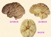 电报性语言是小脑,电报式语言常见于什么失语